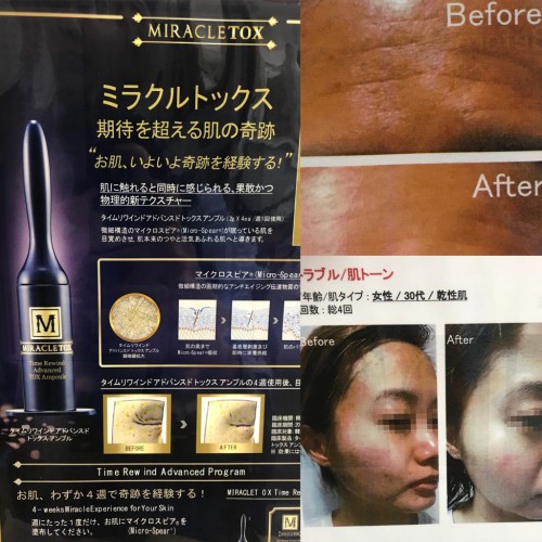 ミラクルトックス!^ – ^!