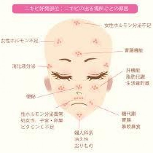 ☆ニキビができる場所によってわかること☆