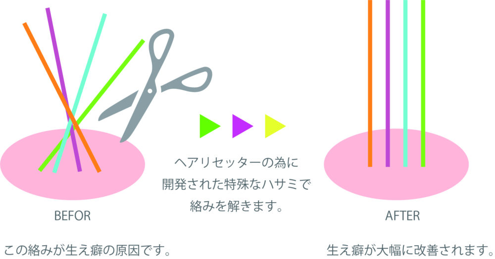 髪の毛は、１つの毛穴から2本〜5本程度の髪が生えています。 この髪が根元周辺で複雑に絡み合うこと（毛髪交差）で、うねりやクセが出ることがわかりました。 リセッターカットはこの絡み合った髪をほどくということで つむじの割れ もみあげの浮き くせ毛とボリュームを強調してしまう 前髪が割れてしまう などの悩みを解消し、お手入れが楽になります。ヘアリセッター