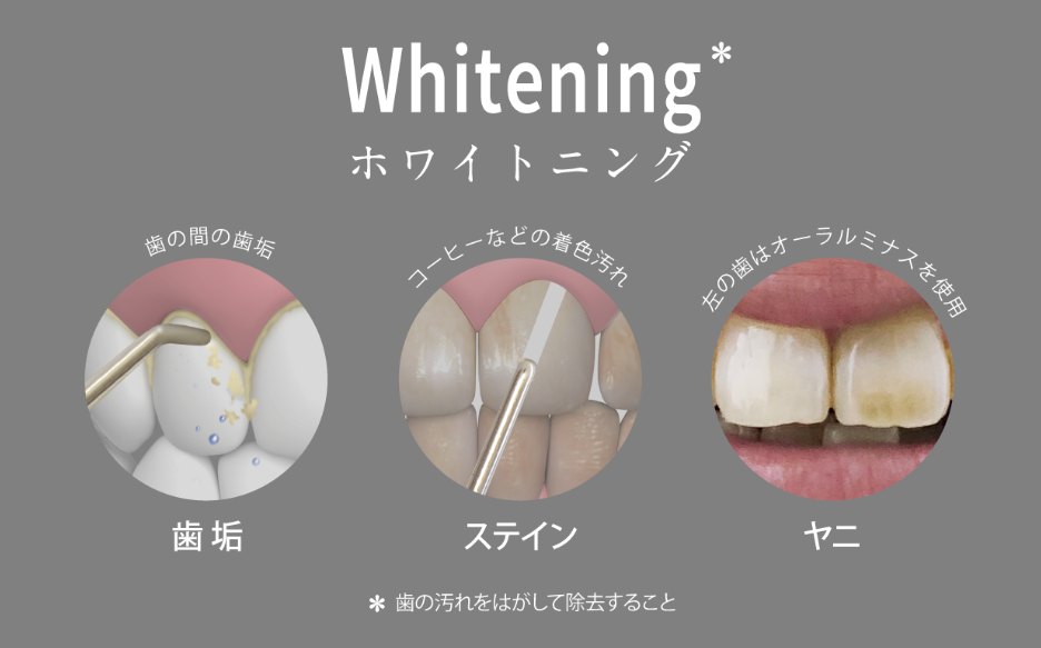 歯垢 ステイン ヤニ ホワイトニング 歯の汚れをはがして除去する事