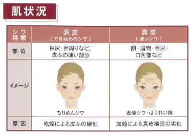 シワの原因・肌状況