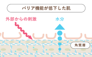 IMPREA(インプレア）乾燥対策　バリア機能が低下した肌